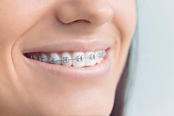 Best General Dentistry  in Linden, TX